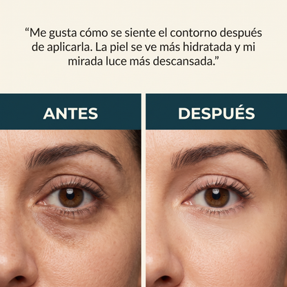 Crema para Ojeras y Bolsas